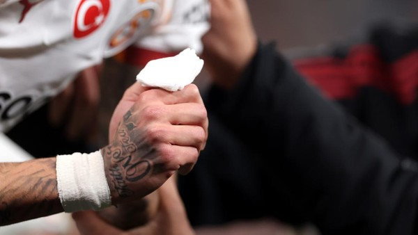 Cedera Horor Noa Lang di Anfield